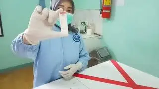 Imunoserologi Pemeriksaan HIV dengan Rapid Test