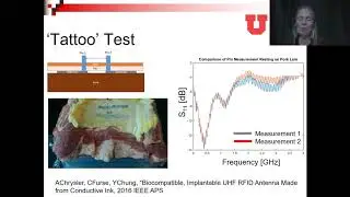 History and Future of Implantable Antennas -- Part 3 (New ideas)