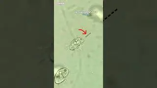 Single Cell Organisms That Jump Under Microscope (Cyclidium)