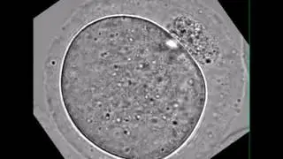 Bayesian Inference of Forces Causing Cytoplasmic Streaming in Caenorhabditis elegans Embryos