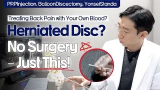 PRP Injection vs. Steroid Injection｜An Orthopedic Spine Specialist Explains