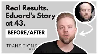 43, Fit, Successful &mdash; But Hair Loss Was Holding Him Back (His Real Transformation)