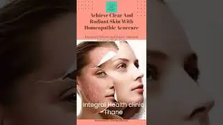 Achieve Clear and Radiant skin with Homeopathic Acnecare