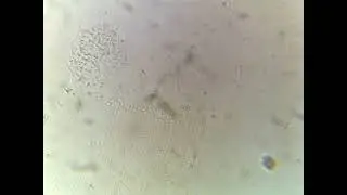 Amoeba