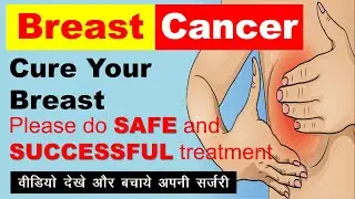 Breast Cancer Cured  | Multiple Success Story | Dr. Arpit Chopra Jain | Modern Homoeopathy