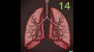USMLE Practice Question for Step 2 CK, IM Shelf, and More | QBANK: PQ#14 - Pulmonary
