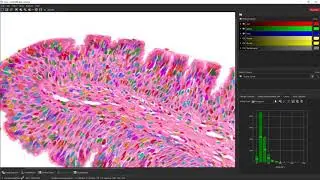 Fast trainable image enhancement and nuclei detection (histology)