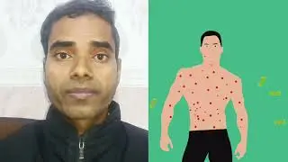 चेचक निकले तो क्या करें #chickenpox #viraldisease #viraldiseases #health #fitness #viral #shorts