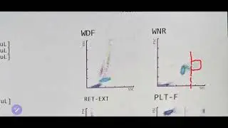 How to interpret WNR channel in Sysmex XN1000 Vet