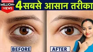 1 ही रात मे आंखों के काले घेरे हटाएं | 💯 Remove Dark Circle | Saloni Swag