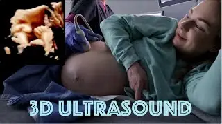 3D/4D ULTRASOUND AT 35 WEEKS PREGNANT!