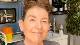 What are skin boosters? Profhilo and Jalupro explained.