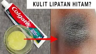 MEMUTIHKAN KULIT LIPATAN YANG HITAM