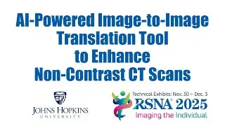 SMILE: Anatomy-Aware Contrast Enhancement
