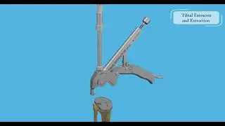 SHUKLA Knee Animated System Overview