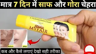 My Fair Cream Review 2025 | my fair cream kaise use kare | myfair cream