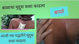 लहान मुलांचा मुद्दुस कसा काढायचा#👉👀🦠🦠#मुलींची शाळा🏢#trading##इन्फॉर्मेटीव##मुद्दुस##parimeenty#