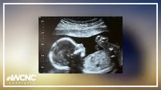 Judge denies Planned Parenthood's motion to pause South Carolina's six-week abortion ban