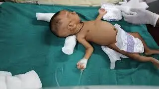 Newborn baby rectum wash | Abdomen distress #newborn #newbornbaby #abdomen