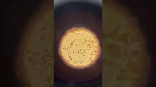 Peritoneal Fluid || Microscopic Examination