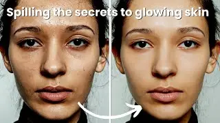why NIACINAMIDE is best for hyperpigmentation