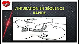 l'intubation en séquence rapide
