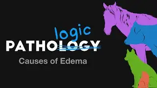 Causes of Edema - PathoLogic