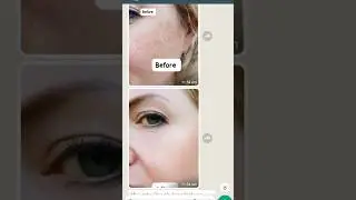 Pakistan best Melasma skin exfoliating lightning glowing organic products #viralvideo #skincare