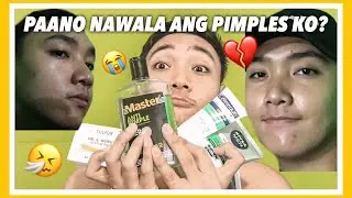 Paano Nawala Ang Pimples Ko? + Skin Care Routine for Men | Paulo Mesina // Philippines