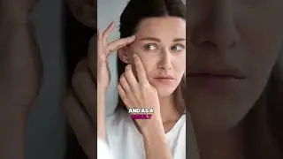 Can You Exercise After Botox?