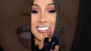The FAMOUS Cardi B: Before & After Plastic Surgery &ndash; Let&rsquo;s Talk! | Dr. Balinger