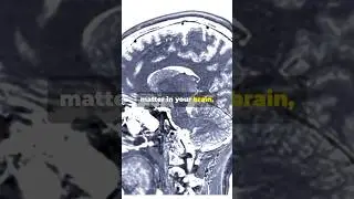 The Sanskrit Effect: How Reciting Sanskrit Rewires your brain #vedichistory #hinduism