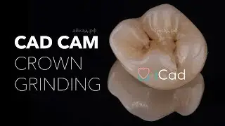 icad cad cam crown Grinding milling process / фрезерование шлифование кад кам коронки