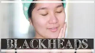 Remove Blackheads At Home | Kris Lumagui
