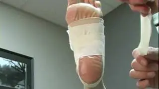 Low-Dye Taping