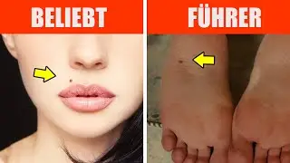 Was Muttermale &uuml;ber dich aussagen