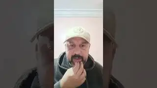 عاجل 🛑 حقيقة مرض سعيد أرا برع الفرشة في لايف