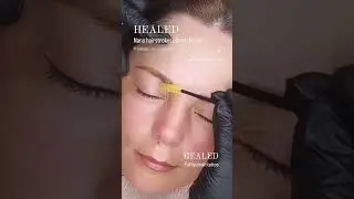 HEALED NANO HAIRSTROKES COMBO BROWS Nano Brows Gold CoastNaturally Healed #nanocombinationbrows