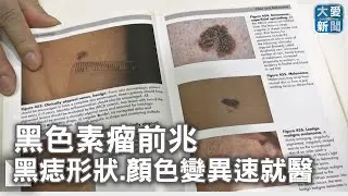 黑色素瘤前兆  黑痣形狀.顏色變異速就醫｜大愛新聞   @DaaiWorldNews