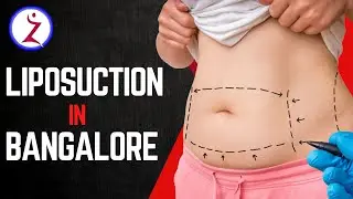 Liposuction in Bangalore | Best Fat Removal Surgery &ndash; Zenith Plastic Surgery