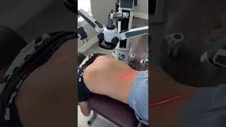 The FX 635 Laser by Erchonia | Back Pain Relief #shorts