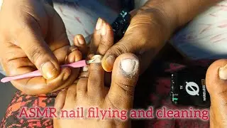 ASMR nail filing and dirt removal PT 1.#asmr #nails #nailcare .
