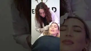 Botox for wrinkles | Enfield Royal Clinic
