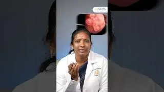 Dr. Usha Rajinikanthan Talks About Managing Work-life Imbalances | SIMS Hospital Vadapalani Chennai