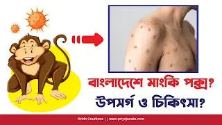বাংলাদেশে MPOX/ MonkeyPOX? MPOX/ MonkeyPOX  উপসর্গ ও প্রতিকার?