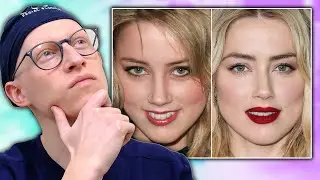 Did Amber Heard Have Lip Surgery? | Dr. Gary Linkov