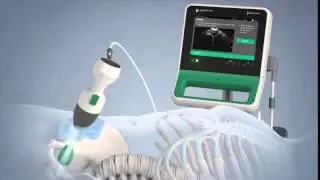 Verathon BladderScan Prime Portable Ultrasound Instrument