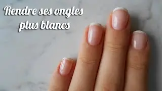 DIY | Rendre ses ongles plus blancs