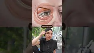 Upper Blepharoplasty: How It Works and What to Expect