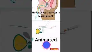 How to pass Catheter in Male Patient? #shorts #animation  #urinarytract #fitness #health